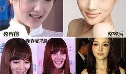 成都整形爆料事件视频,揭秘行业黑幕与真实案例